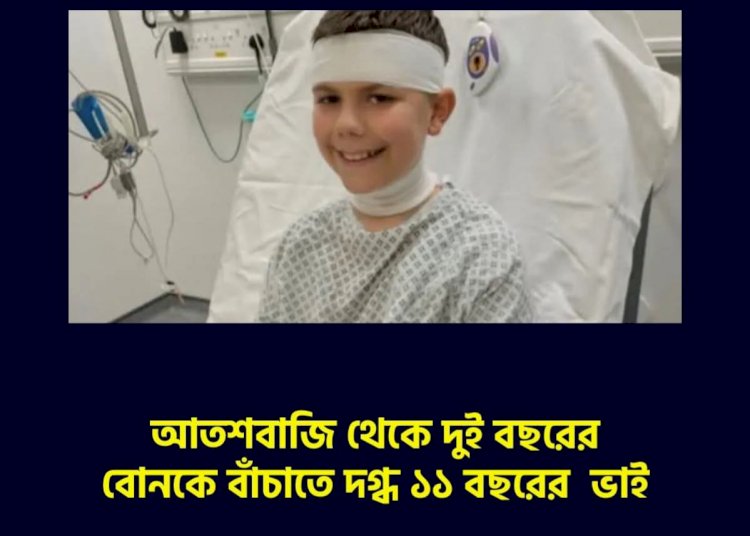 আতশবাজি থেকে দুই বছরের বোনকে বাঁচাতে দগ্ধ ১১ বছরের  ভাই